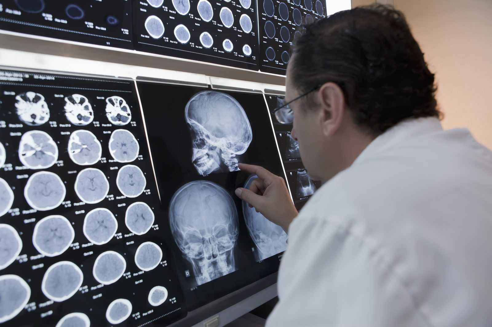 A physician reviewing brain scans on a diagnostic workstation
